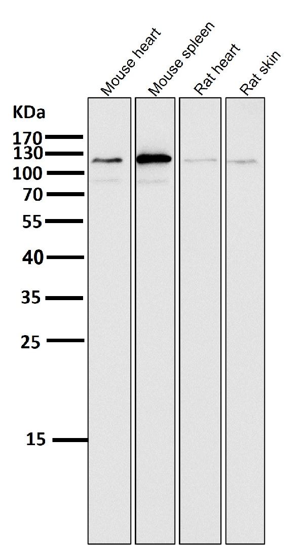 1 - Anti-ERK5 Rabbit Monoclonal Antibody ABO13464
