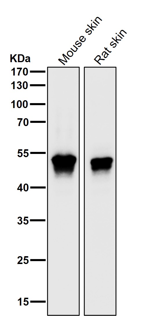 1 - Anti-MEK5 Rabbit Monoclonal Antibody ABO13465