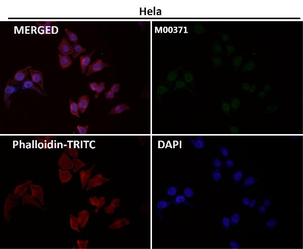1 - Anti-ATF4 Rabbit Monoclonal Antibody ABO13467