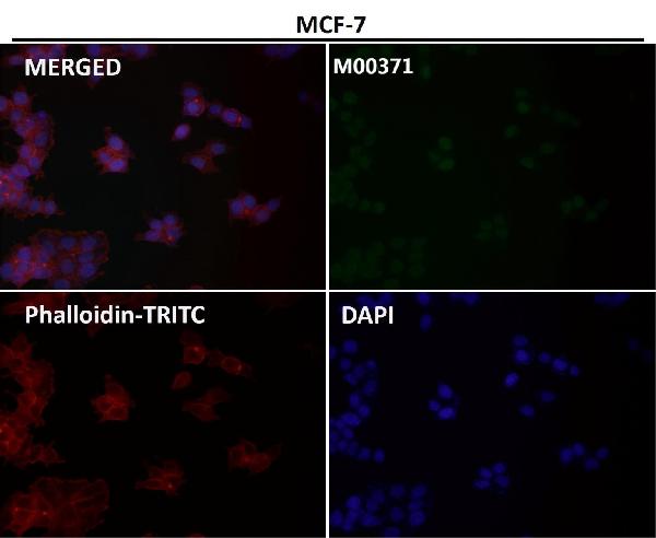 1 - Anti-ATF4 Rabbit Monoclonal Antibody ABO13467