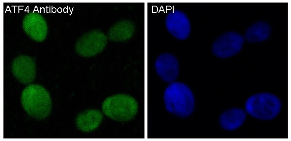 3 - Anti-ATF4 Rabbit Monoclonal Antibody ABO13467
