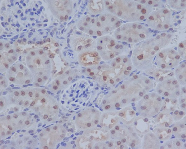 2 - Anti-ATF4 Rabbit Monoclonal Antibody ABO13467