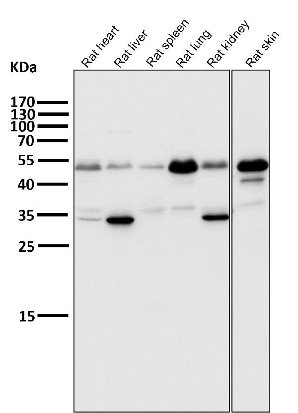1 - Anti-ATF4 Rabbit Monoclonal Antibody ABO13467