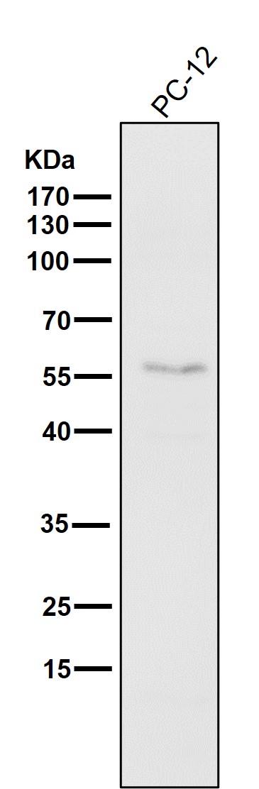 1 - Anti-ATF4 Rabbit Monoclonal Antibody ABO13467