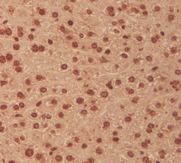 2 - Anti-MEK3 MAP2K3 Rabbit Monoclonal Antibody ABO13468