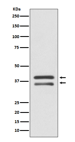 1 - Anti-MEK3 MAP2K3 Rabbit Monoclonal Antibody ABO13468