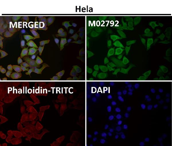 1 - Anti-ATF5 Rabbit Monoclonal Antibody ABO13469