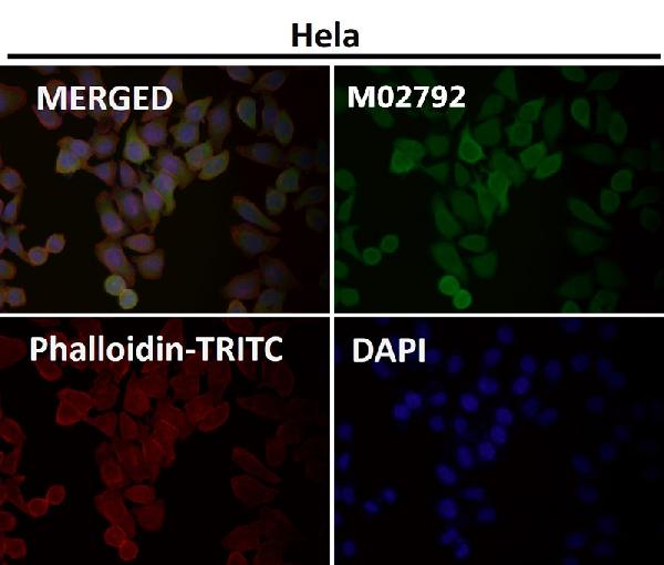 1 - Anti-ATF5 Rabbit Monoclonal Antibody ABO13469