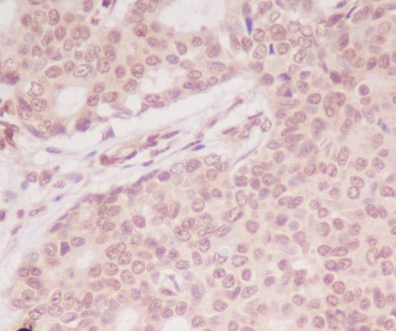 2 - Anti-ATF5 Rabbit Monoclonal Antibody ABO13469