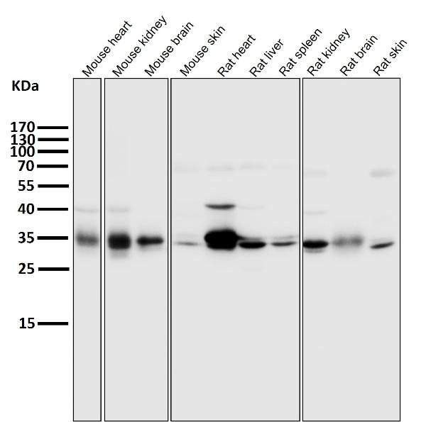 1 - Anti-ATF5 Rabbit Monoclonal Antibody ABO13469