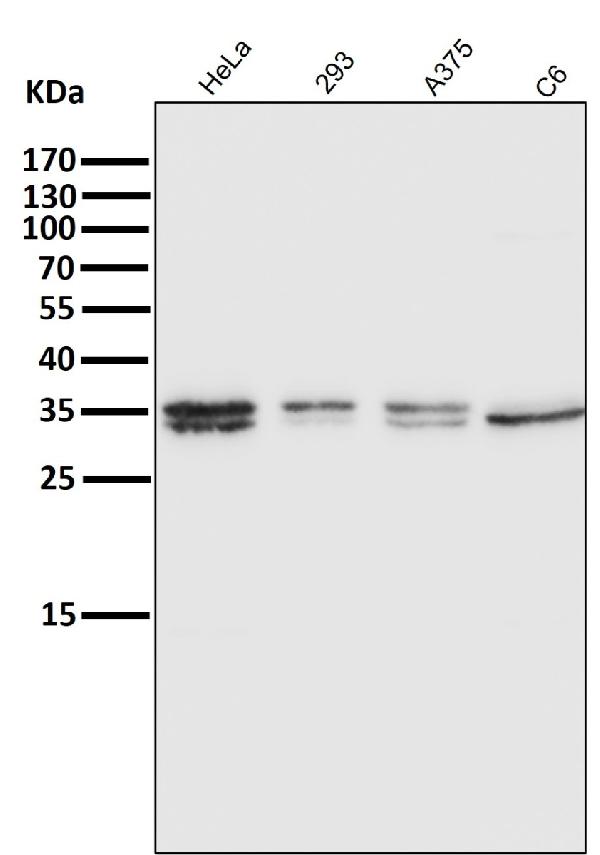 1 - Anti-ATF5 Rabbit Monoclonal Antibody ABO13469