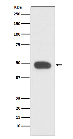 1 - Anti-PAX6 Rabbit Monoclonal Antibody ABO13470