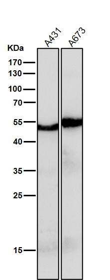 1 - Anti-PAX6 Rabbit Monoclonal Antibody ABO13470