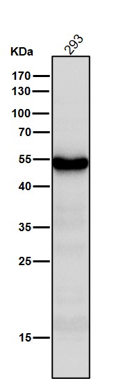 1 - Anti-PAX6 Rabbit Monoclonal Antibody ABO13470