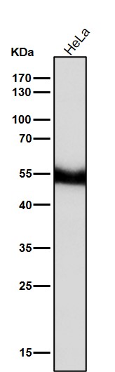 1 - Anti-PAX6 Rabbit Monoclonal Antibody ABO13470