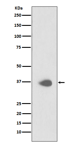 1 - Anti-PAX9 Rabbit Monoclonal Antibody ABO13472
