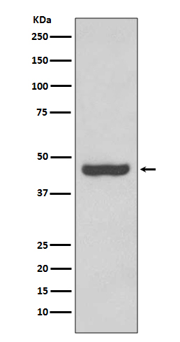 1 - Anti-PAX2 Rabbit Monoclonal Antibody ABO13473