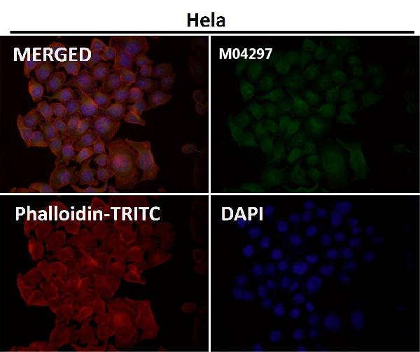 1 - Anti-JNK3 Rabbit Monoclonal Antibody ABO13474