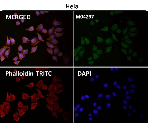 1 - Anti-JNK3 Rabbit Monoclonal Antibody ABO13474