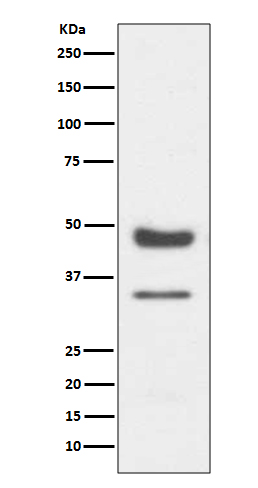 1 - Anti-PAX6 Rabbit Monoclonal Antibody ABO13476