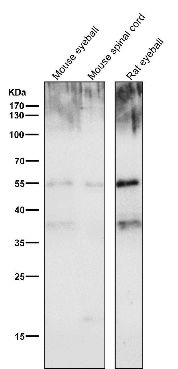 1 - Anti-PAX6 Rabbit Monoclonal Antibody ABO13476