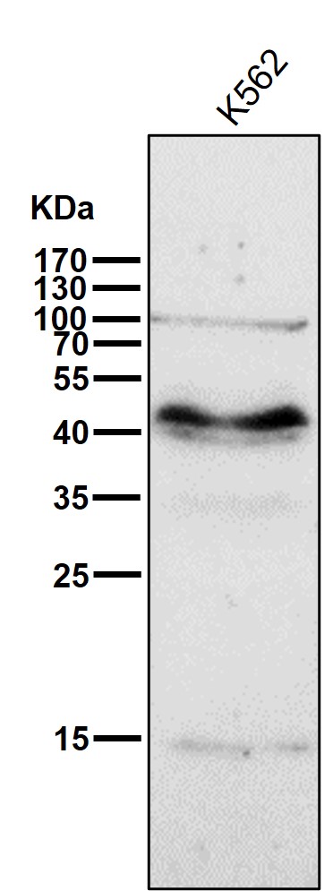 1 - Anti-PAX6 Rabbit Monoclonal Antibody ABO13476