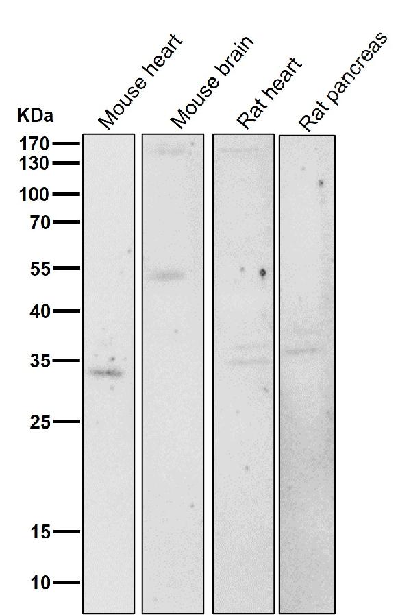1 - Anti-PAX6 Rabbit Monoclonal Antibody ABO13476
