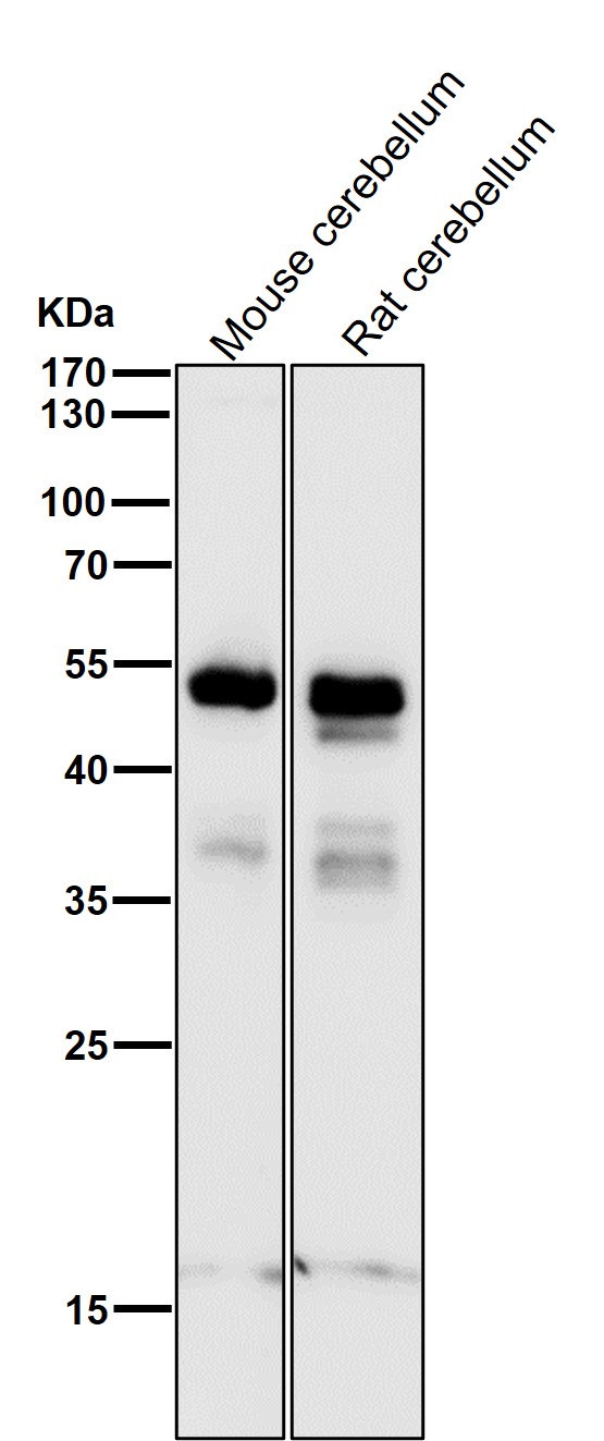 1 - Anti-PAX6 Rabbit Monoclonal Antibody ABO13476