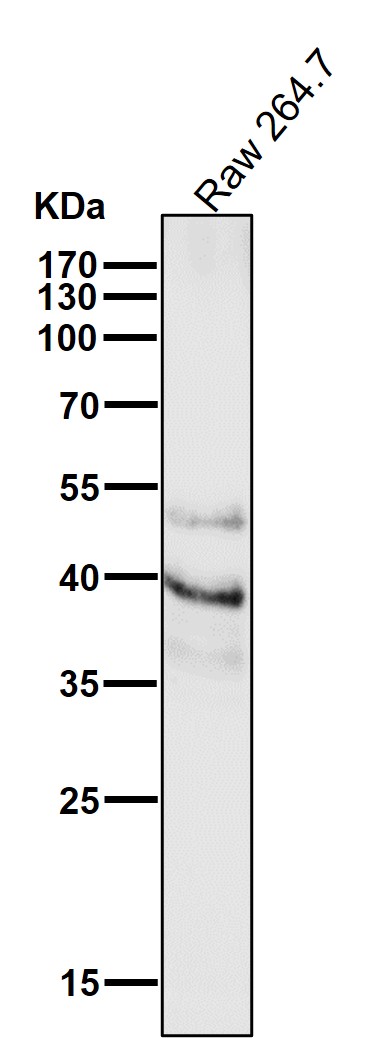 1 - Anti-PAX6 Rabbit Monoclonal Antibody ABO13476