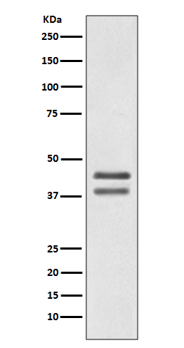 1 - Anti-JunD Rabbit Monoclonal Antibody ABO13478