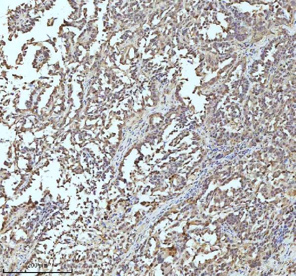 2 - Anti-UBA1/Ube1 Rabbit Monoclonal Antibody ABO13481