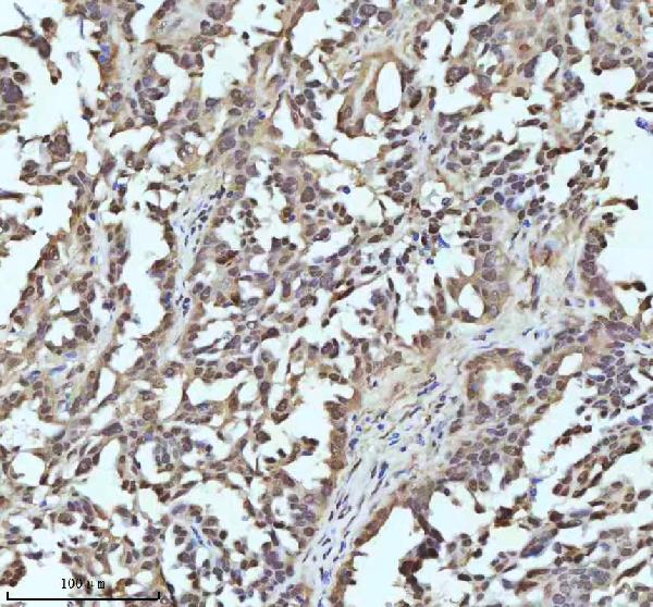 2 - Anti-UBA1/Ube1 Rabbit Monoclonal Antibody ABO13481