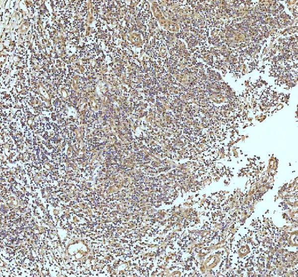 2 - Anti-UBA1/Ube1 Rabbit Monoclonal Antibody ABO13481