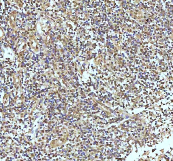 2 - Anti-UBA1/Ube1 Rabbit Monoclonal Antibody ABO13481