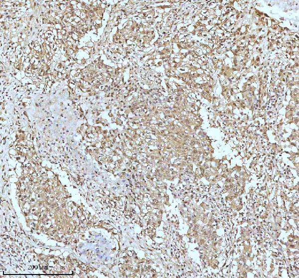 2 - Anti-UBA1/Ube1 Rabbit Monoclonal Antibody ABO13481