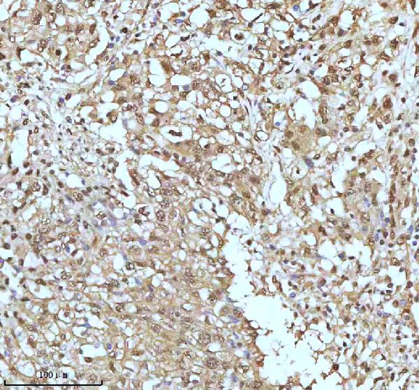 2 - Anti-UBA1/Ube1 Rabbit Monoclonal Antibody ABO13481