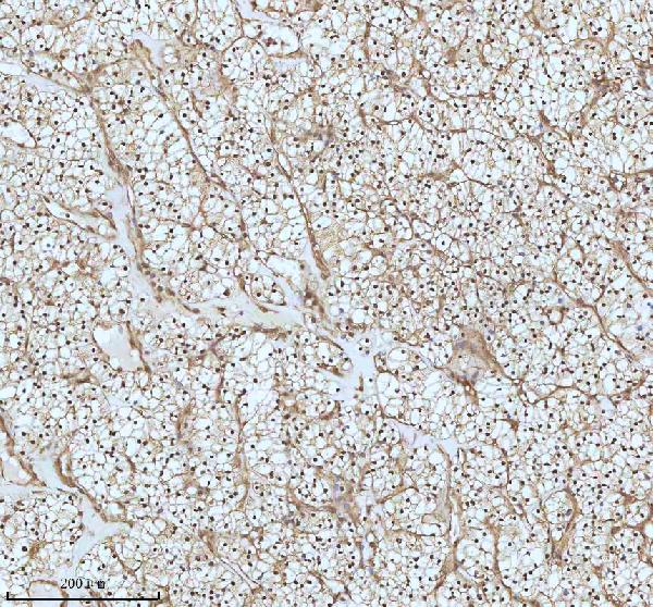 2 - Anti-UBA1/Ube1 Rabbit Monoclonal Antibody ABO13481