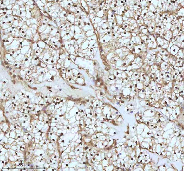 2 - Anti-UBA1/Ube1 Rabbit Monoclonal Antibody ABO13481