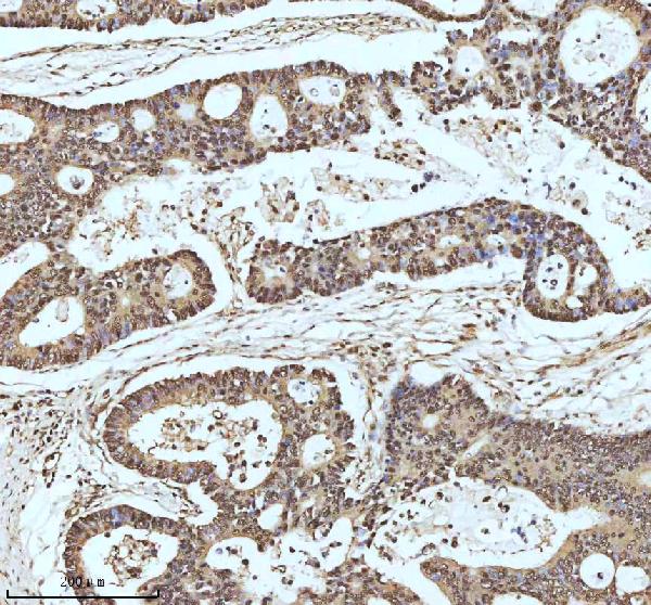 2 - Anti-UBA1/Ube1 Rabbit Monoclonal Antibody ABO13481