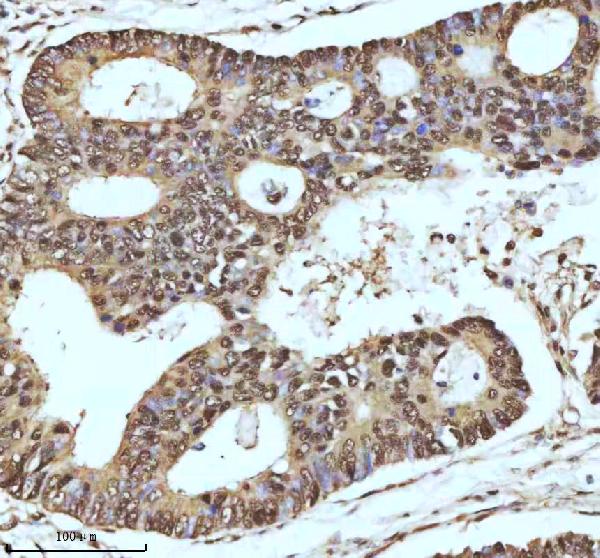 2 - Anti-UBA1/Ube1 Rabbit Monoclonal Antibody ABO13481
