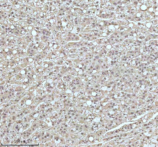 2 - Anti-UBA1/Ube1 Rabbit Monoclonal Antibody ABO13481