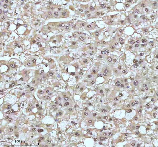 2 - Anti-UBA1/Ube1 Rabbit Monoclonal Antibody ABO13481