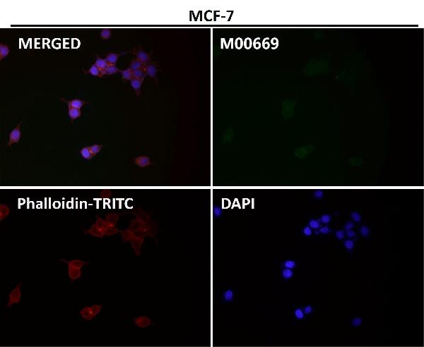 1 - Anti-PAX5/Bsap Rabbit Monoclonal Antibody ABO13483
