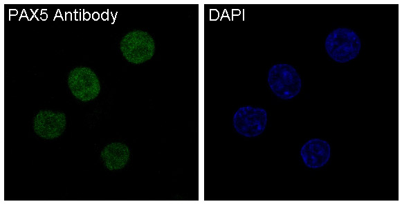 3 - Anti-PAX5/Bsap Rabbit Monoclonal Antibody ABO13483