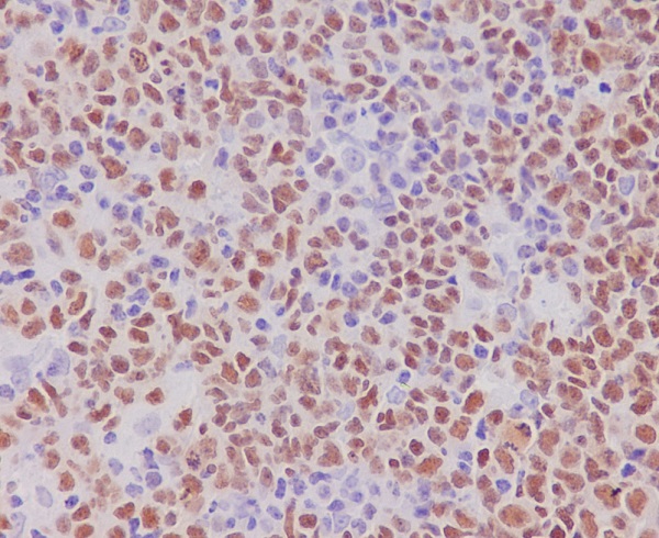 2 - Anti-PAX5/Bsap Rabbit Monoclonal Antibody ABO13483