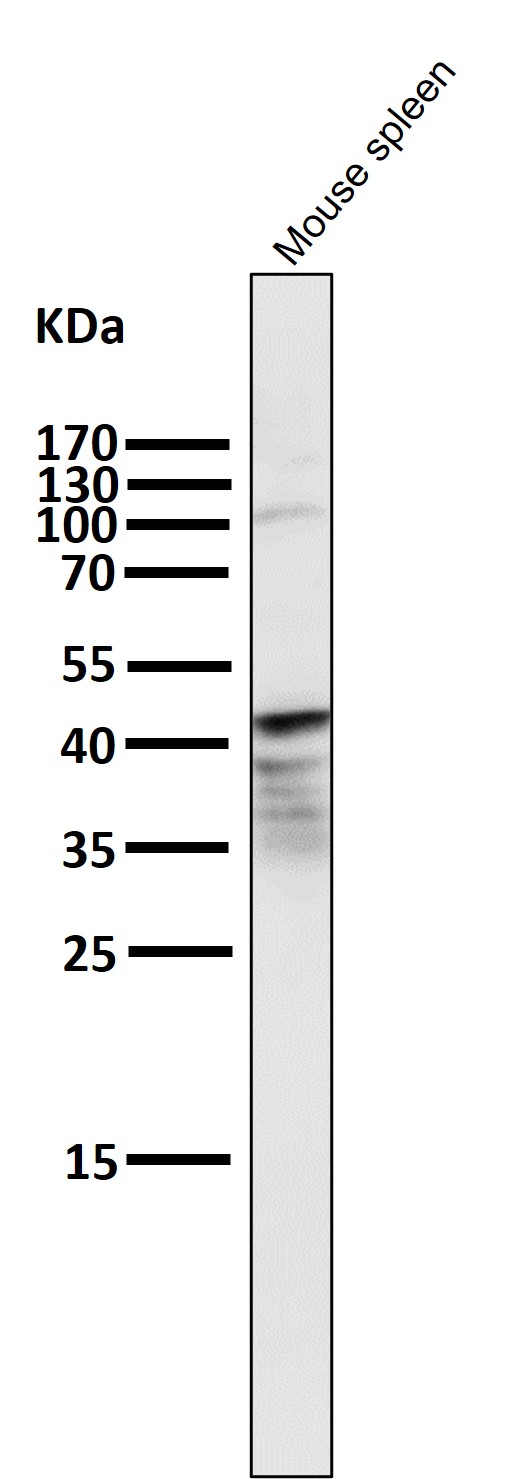 1 - Anti-PAX5/Bsap Rabbit Monoclonal Antibody ABO13483