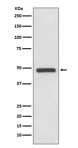 1 - Anti-PAX8 Rabbit Monoclonal Antibody ABO13484