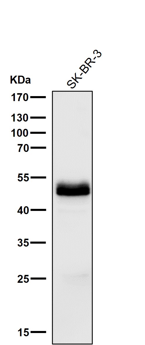 1 - Anti-PAX8 Rabbit Monoclonal Antibody ABO13484