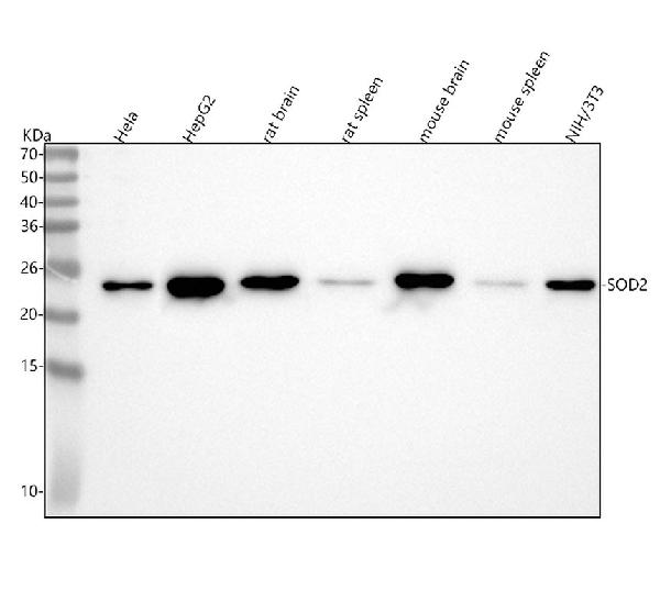 1 - Anti-SOD2/Mnsod Rabbit Monoclonal Antibody ABO13485