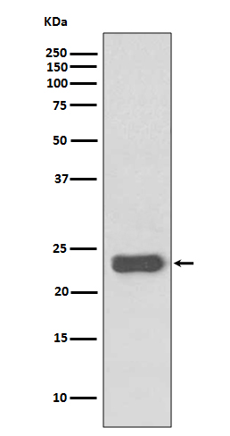 1 - Anti-MGMT Rabbit Monoclonal Antibody ABO13486